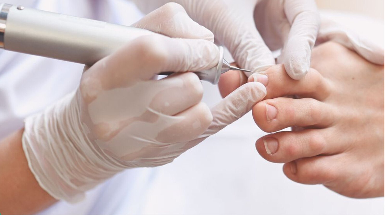Non-Medical Podology for Complex Feet
